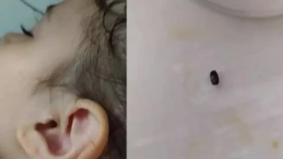 İzmit’te parkta 3 yaşındaki çocuğun kulağına kene yapıştı