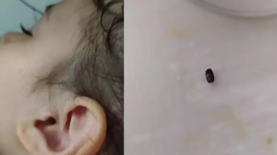 İzmit’te parkta 3 yaşındaki çocuğun kulağına kene yapıştı