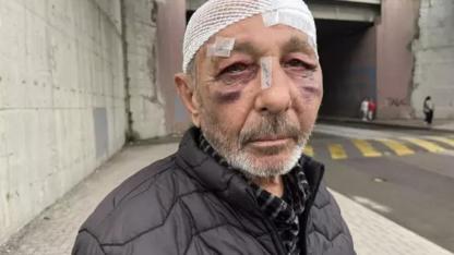 Önce çakmak istediler ardından sokak ortasında darbettiler