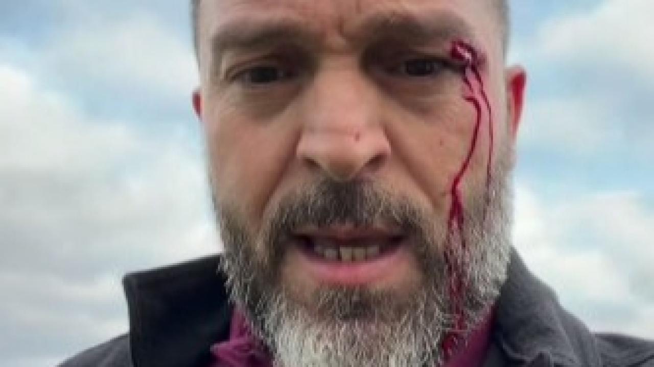 Gazeteci Hakan Süer'e çirkin saldırı !